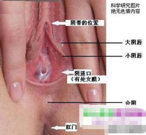 女性生殖器